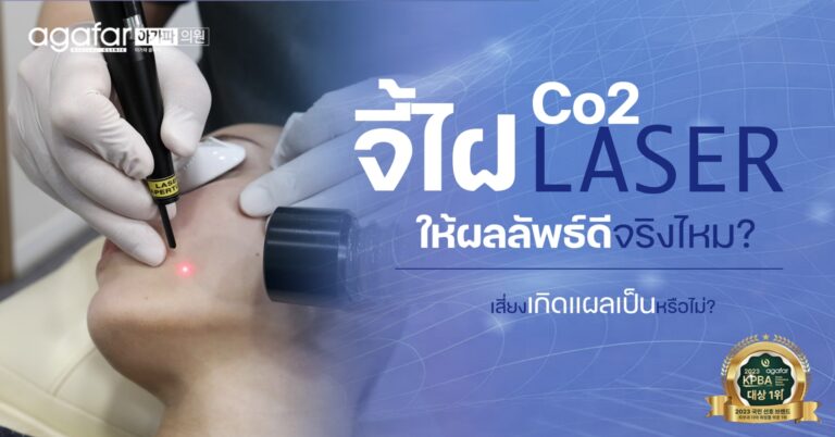 จี้ไฝ ด้วย Co2 Laser ดีจริงไหม เป็นแผลเป็นหรือเปล่า