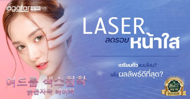 Laser หน้าใส ต้องเตรียมตัวอย่างไรเพื่อให้ได้ผลลัพธ์ที่ดี มีแจกฟรีด้วย