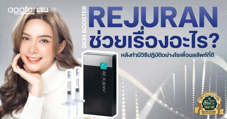 Rejuran ช่วยอะไร แล้วหลังทำมีวิธีปฏิบัติอย่างไร?